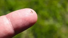 Jak se zbavit třísek bez jehel a bolesti